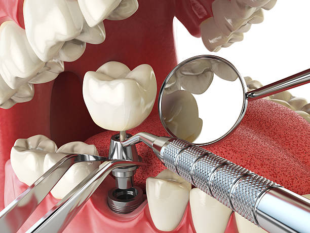 Best Emergency Gum Treatment in La Mesilla, NM